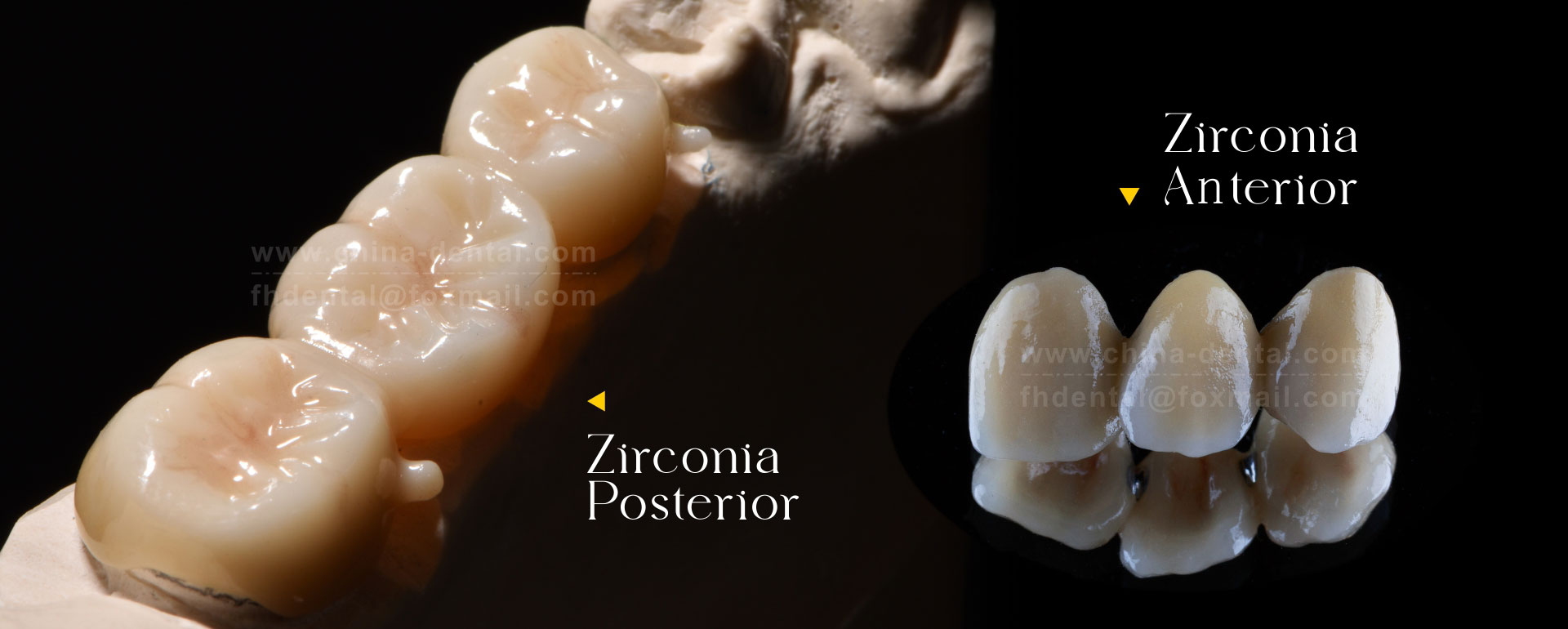 Zirconia Posterior