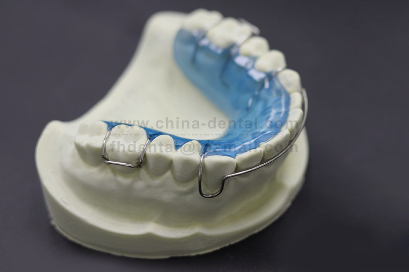 Hawley Retainer: A Comfortable and Reliable Dental Guardian