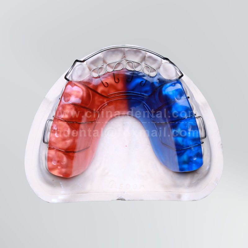 Guide Arch Lingual Spring Appliance	