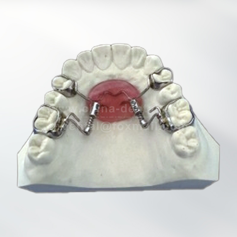 Distal Jet Appliance	