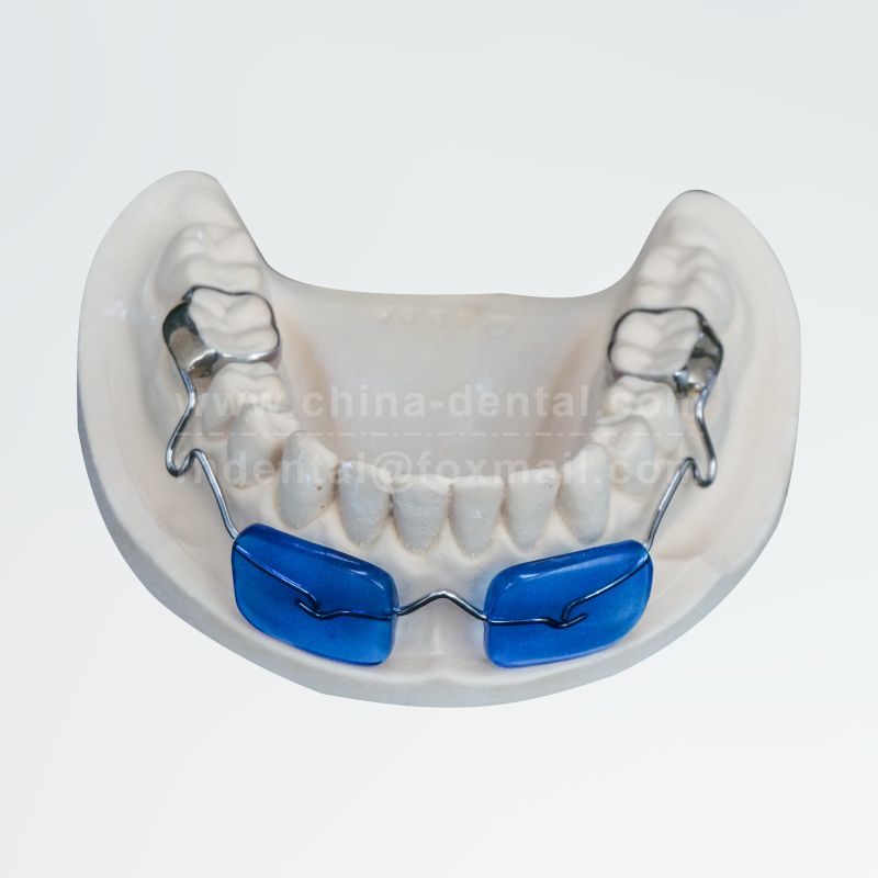 Mandibular Lip Bumper (Band-anchored)
