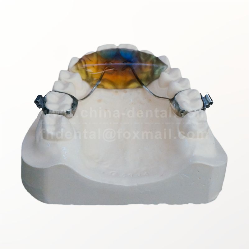 Maxillary Plane Plate(Band-anchored)	