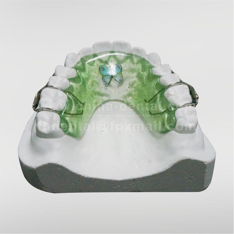 Bonded Retainer