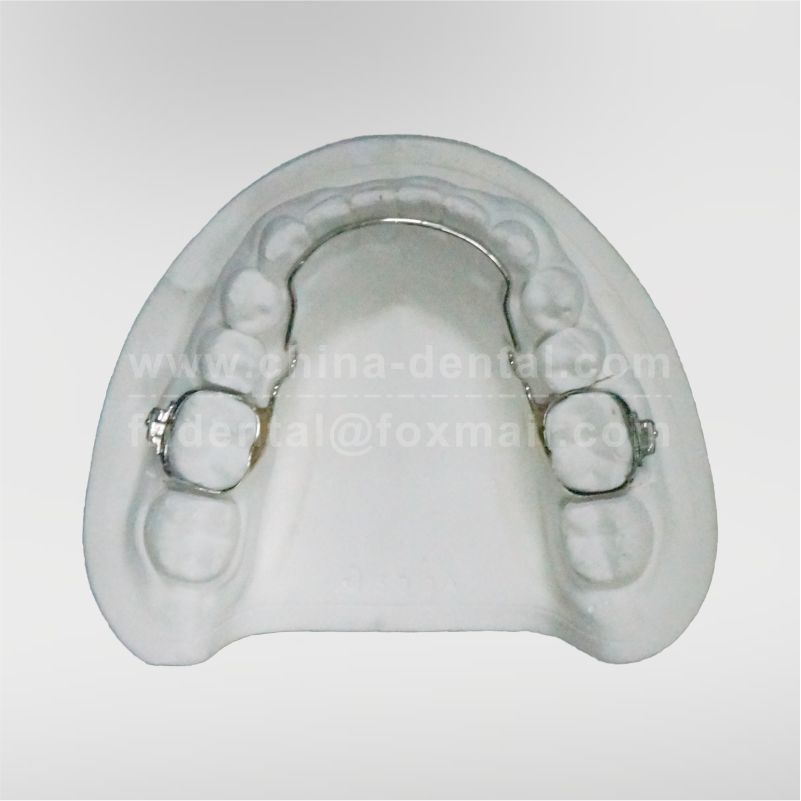 Lingual arch space maintainer