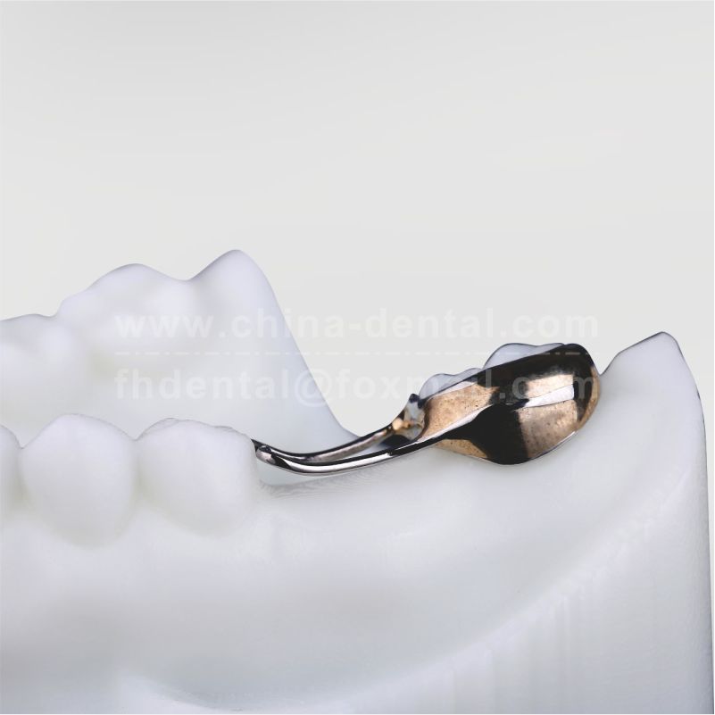 Band and Loop Space Maintainer(Standard Type)	