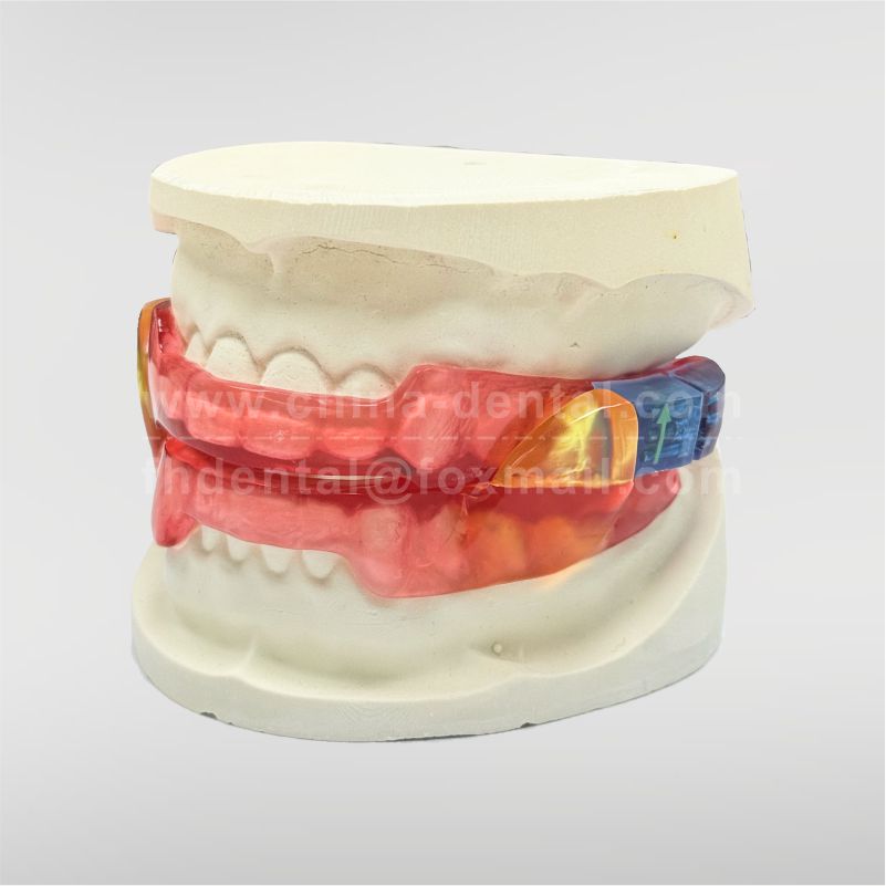 Shark Anti-snoring Device