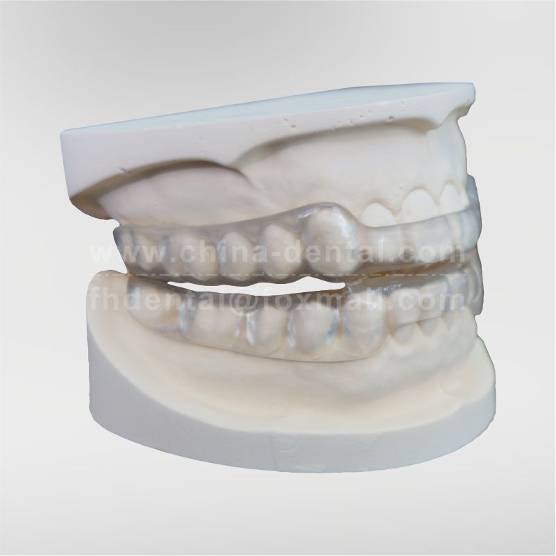 Shark Anti-Snoring Device(integrated upper and lower support, soft inside and hard outside)