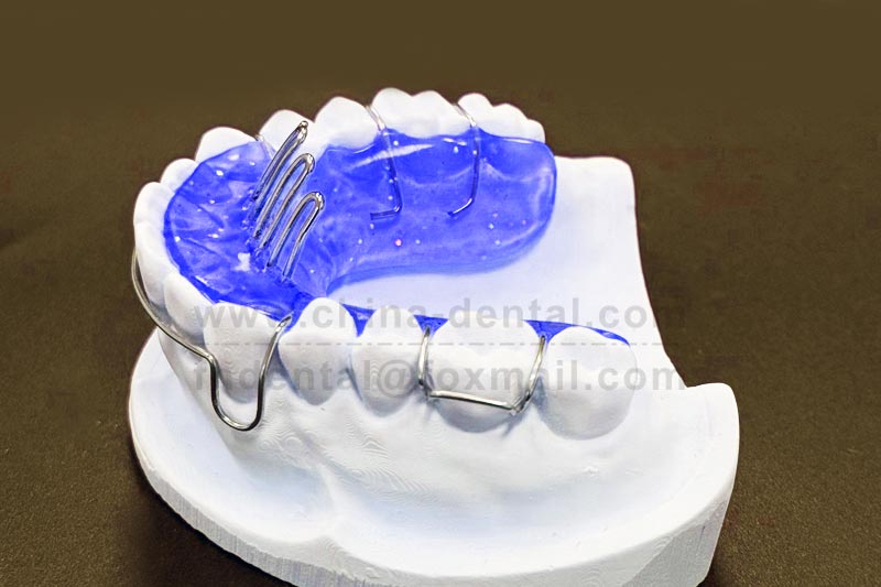Eliminate Bad Oral Habits, Protect Children's Dental Health – Introduction to the Tongue Grid Appliance