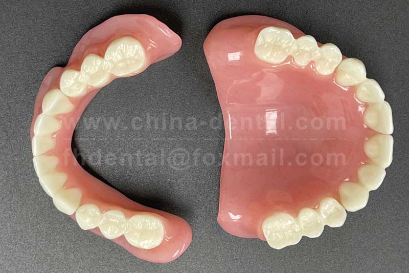 A Stable New Choice: Suction Dentures for a Secure Fit in Full Dentures