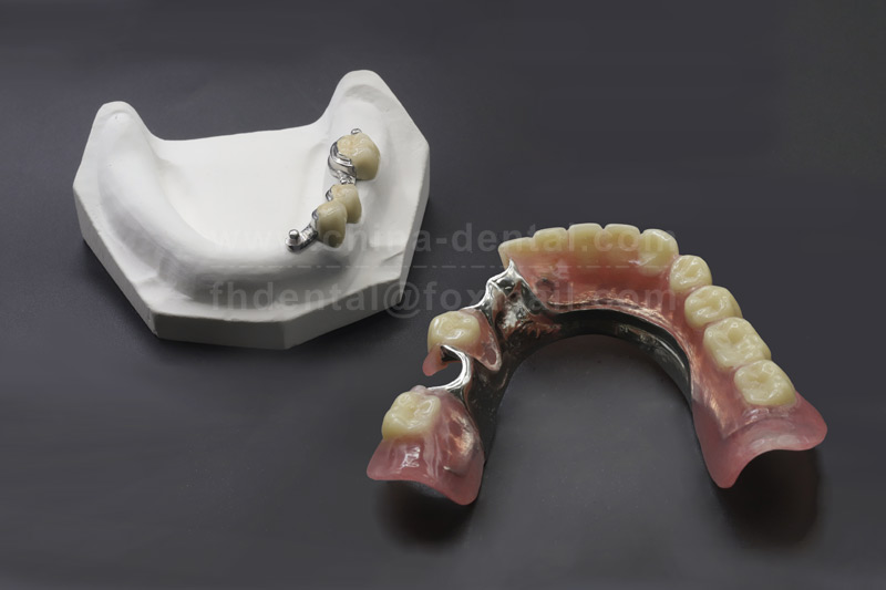 Stable Chewing, Natural Feel—Experience the Reassuring Choice of Precision Attachment Dentures Stable Chewing, Natural Feel—Experience the Reassuring Choice of Precision Attachment Dentures
