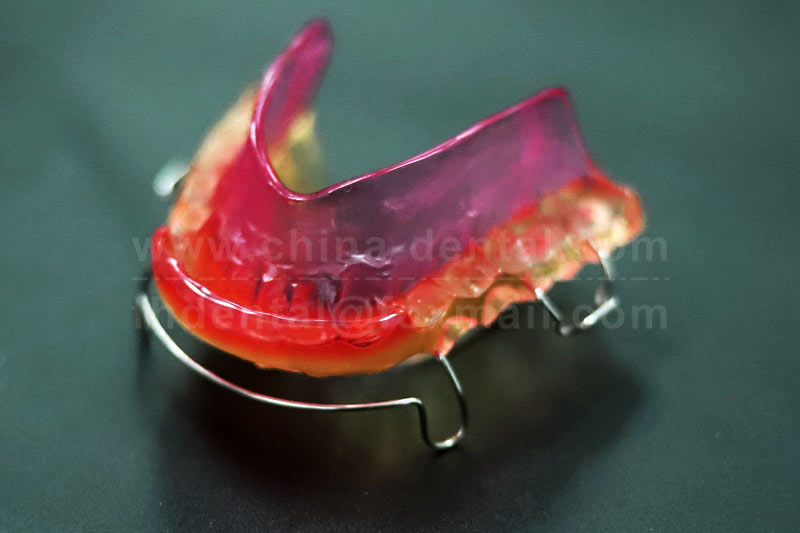 Activator: An Early Correction Option for Adolescent Malocclusion Activator: An Early Correction Option for Adolescent Malocclusion