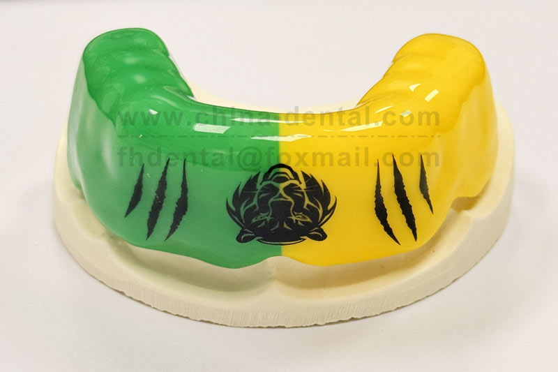 Customized for You, Comfort on the Move: Your Personalized Sports Mouthguard Customized for You, Comfort on the Move: Your Personalized Sports Mouthguard