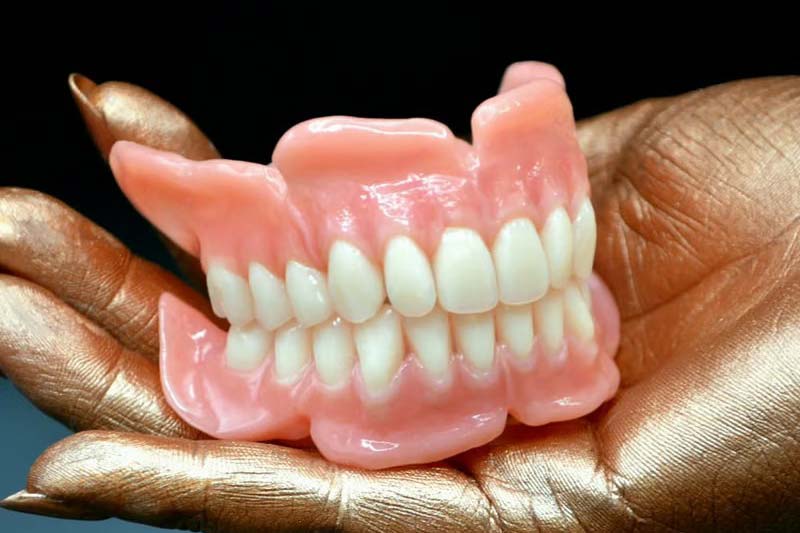 Acrylic Dentures: Comfortable and Practical, Restoring Natural Chewing and Smiles