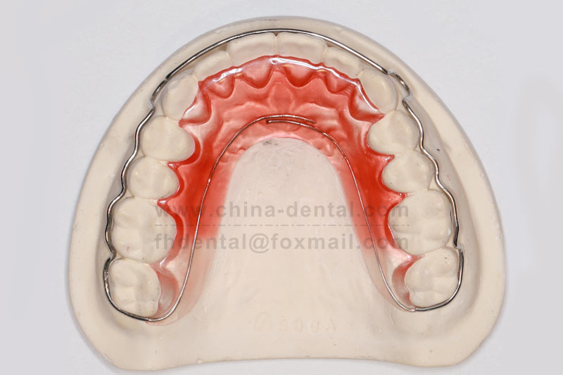 Begg Retainer: A Reliable Choice for Consolidating Orthodontic Results