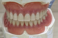 Say Goodbye to Long Waits: Suction Dentures Let You Wear and Eat on the Same Day Say Goodbye to Long Waits: Suction Dentures Let You Wear and Eat on the Same Day