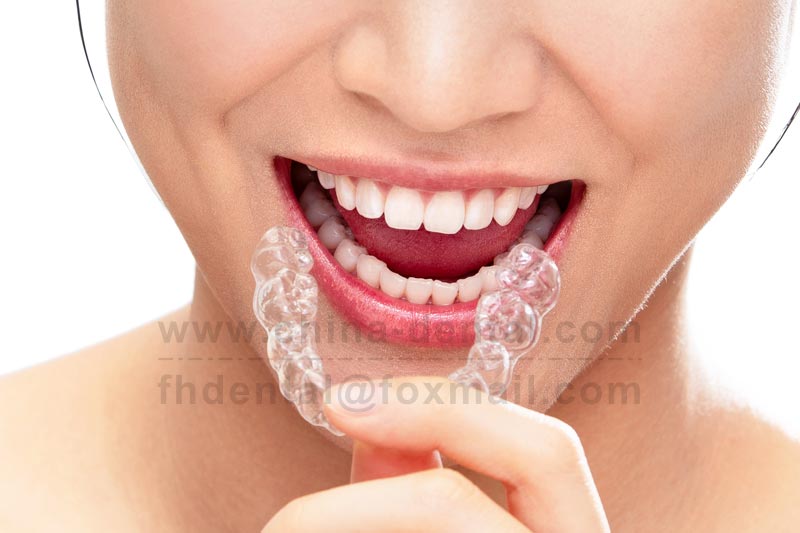 Subtle Transformation: Clear Aligners for a More Natural Smile
