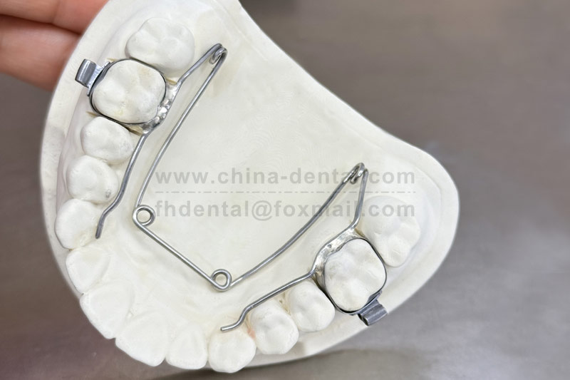 Four-Eye Spring Expander: A Gentle and Reliable Choice for Arch Width Adjustment