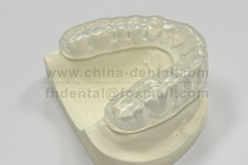 Night Guard: Protecting Your Teeth While You Sleep