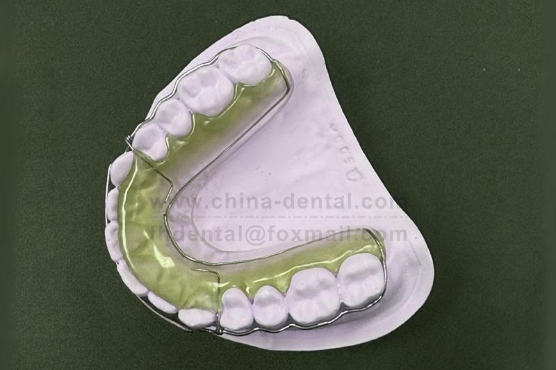 Begg Circumferential Retainer: A Stable Defense After Orthodontic Treatment