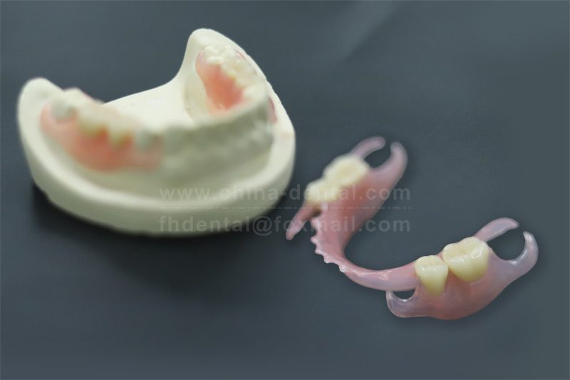 A Kinder Option for "Clasped Teeth": A Gentle Way to Replace Missing Teeth A Kinder Option for "Clasped Teeth": A Gentle Way to Replace Missing Teeth