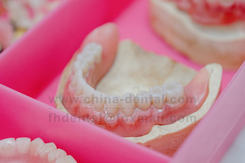 Complete Suction Dentures: Say Goodbye to Loose Dentures for Good
