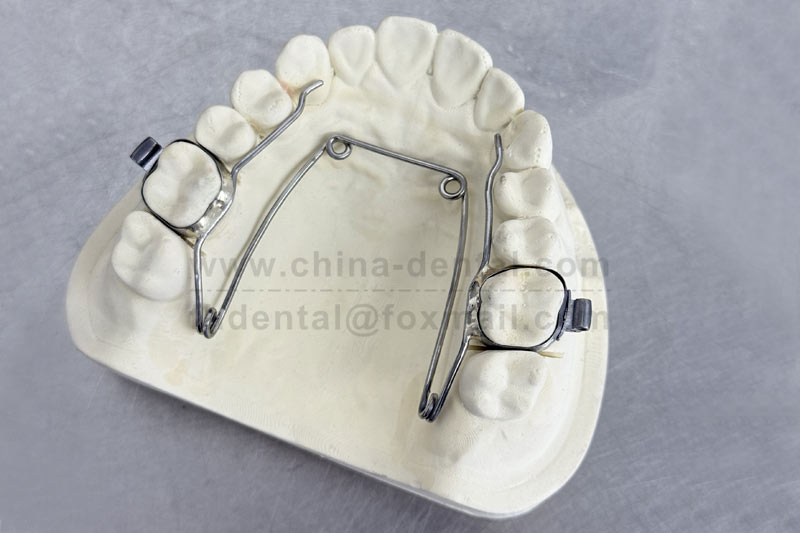 Narrow dental arch causing teeth to crowd together? The Four-Eye Spring Expander is a gentle and effective helper.