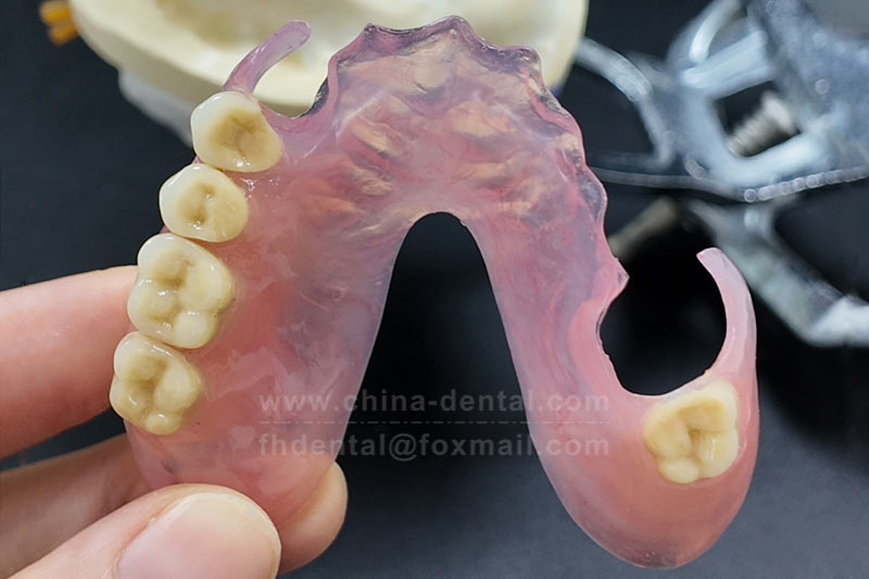 Dentures Without Metal Clasps – You’ll Know How Easy They Are Once You Try Them