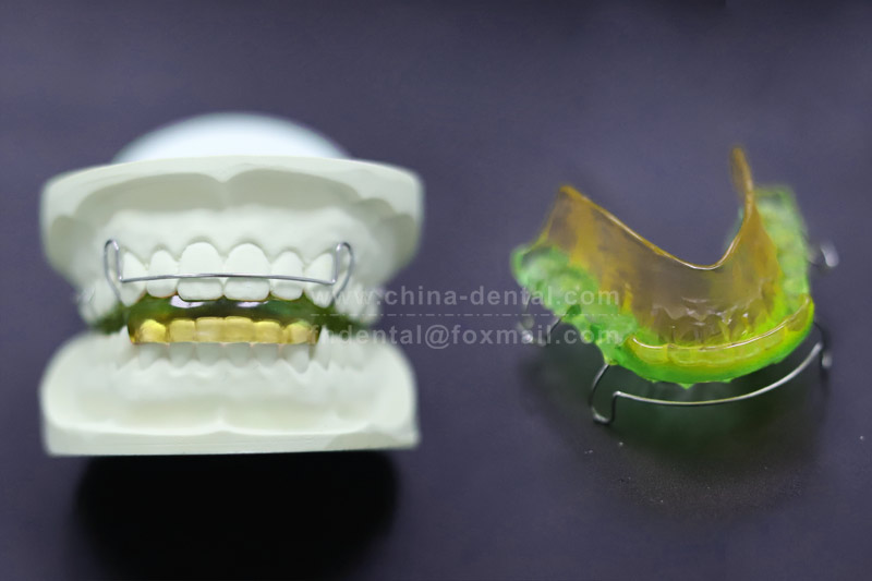 Muscle Activator: The Dental ＂Navigator＂ for Mixed Dentition, Guiding Normal Jaw Development