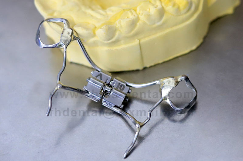 More Than Just Widening the Arch: The Hyrax Rapid Expander Helps the Maxilla Grow Forward