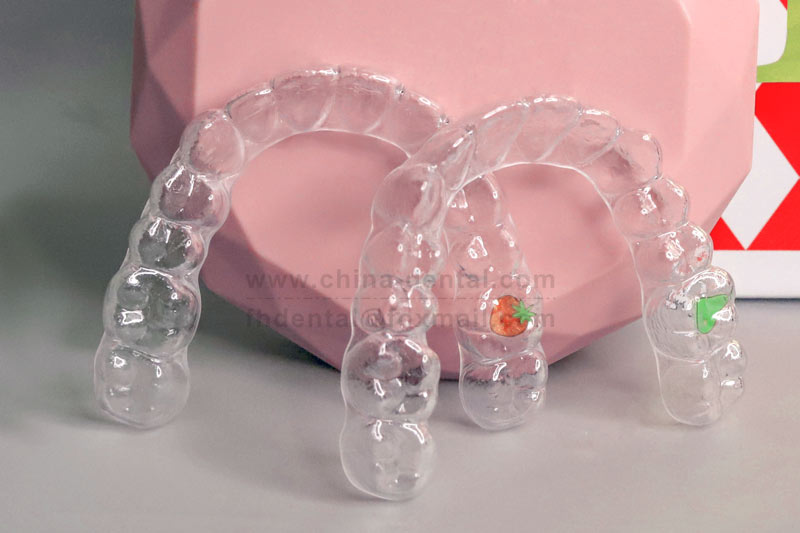 Don't Get Careless After Removing Your Braces: How Long Should You Wear Your Clear Retainer?