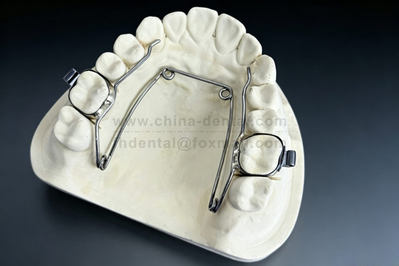 Four-Eye Spring Expander – Easily Resolve Dental Crowding and Transverse Discrepancy Four-Eye Spring Expander – Easily Resolve Dental Crowding and Transverse Discrepancy