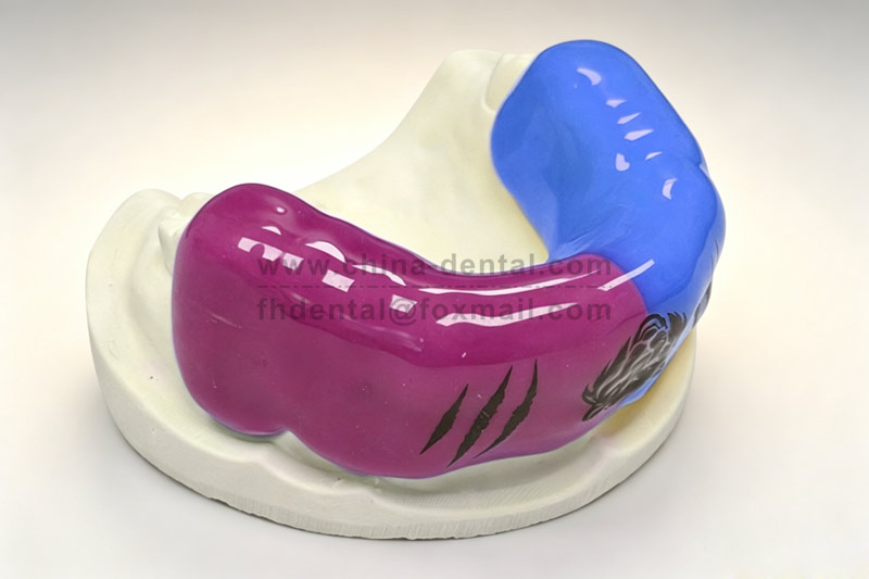 Three Thickness Options Available: Sports Mouthguard Lets You Compete with Confidence Three Thickness Options Available: Sports Mouthguard Lets You Compete with Confidence