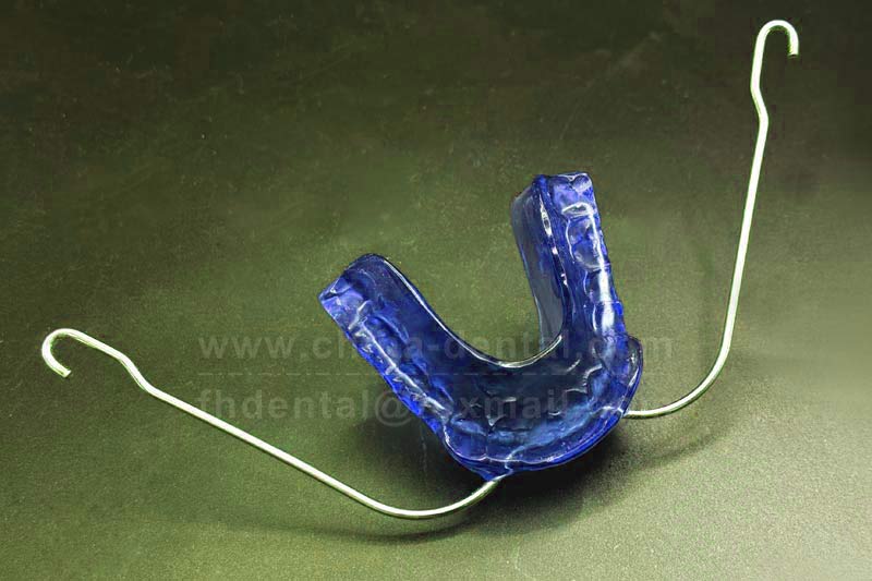 Correct “buck teeth” while sleeping? The Van Beek appliance makes mixeddentition treatment easier.