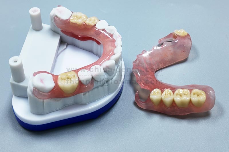 Say goodbye to the embarrassment of metal clasps; flexible partials make restoration elegant.
