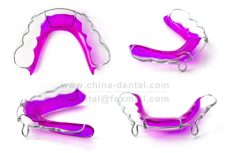 Begg Retainer – The Last Line of Defense After Braces Come Off