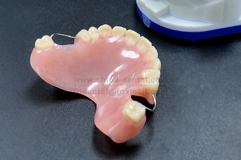 Acrylic Denture Makes Eating and Smiling Easier